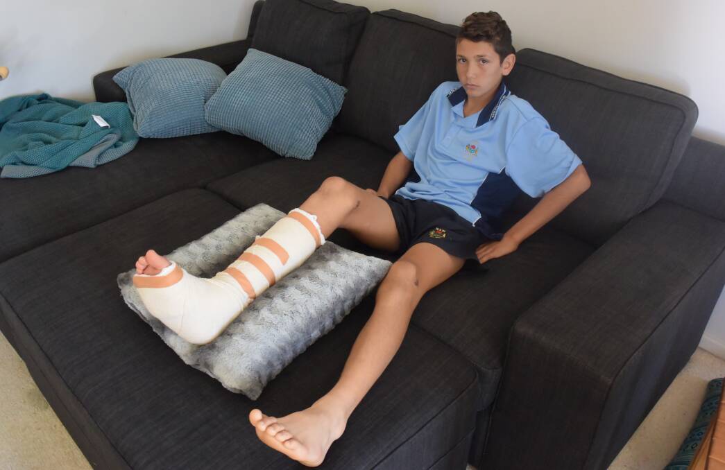 Season over: Nav Willett at home with his leg in plaster after suffering a break playing for the NSW PSSA rugby league sides.