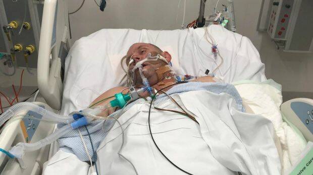 Jeff Back is fighting for his life at The Alfred hospital after contracting a deadly flesh-eating bacterial infection.  Photo: Supplied
