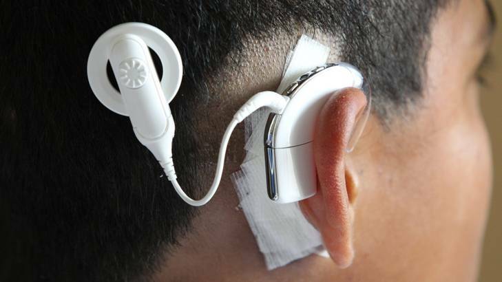 Devices of the calibre of the cochlear implant are being sought.